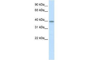 Transfected 293T; WB Suggested Anti-NEUROD6 Antibody Titration: 0. (NEUROD6 anticorps  (N-Term))