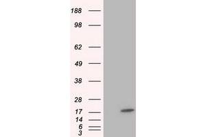 HEK293T cells were transfected with the pCMV6-ENTRY control (Left lane) or pCMV6-ENTRY TTC32 (Right lane) cDNA for 48 hrs and lysed. (TTC32 anticorps)