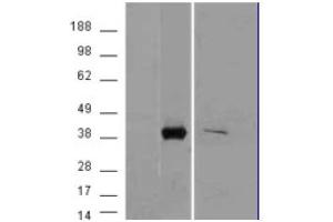 Image no. 2 for anti-Aldo-Keto Reductase Family 1, Member B10 (Aldose Reductase) (AKR1B10) (C-Term) antibody (ABIN374920) (AKR1B10 anticorps  (C-Term))