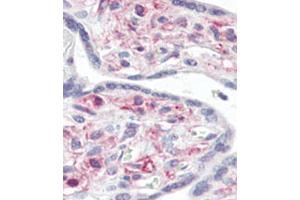 Immunohistochemical analysis of formalin-fixed and paraffin-embedded human Placenta tissue reacted with IRAK Antibody (C-term), which was peroxidase-conjugated to the secondary antibody, followed by AEC staining. (IRAK1 anticorps)