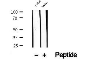 Western blot analysis of extracts of Jurkat cells, using GSDMD antibody.