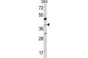 Western blot analysis of NAGK (arrow) in 293 cell line lysates (35ug/lane) using NAGK  Antibody (C-term). (NAGK anticorps  (C-Term))