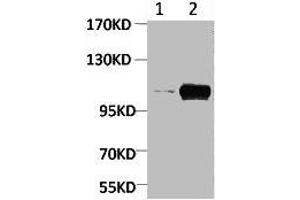 Western blot analysis of Maize 1) Dark, 2) Light, diluted at 1:2000. (PGC anticorps  (pSer15))
