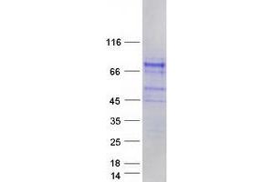 Validation with Western Blot