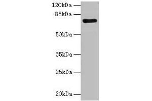Western blot All lanes: KAT7 antibody at 2 μg/mL + Rat brain tissue Secondary Goat polyclonal to rabbit IgG at 1/10000 dilution Predicted band size: 71, 59, 52, 67, 56 kDa Observed band size: 71 kDa (MYST2 anticorps  (AA 1-214))