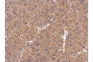 IHC-P Image Immunohistochemical analysis of paraffin-embedded U87 xenograft, using FMNL1, antibody at 1:500 dilution.