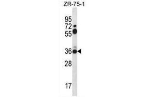 Western blot analysis in ZR-75-1 cell line lysates (35µg/lane) using Syntaxin 2 / STX2 Antibody (Center) Cat. (STX2 anticorps  (Middle Region))