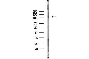 Western blot analysis of lysates from PC12 cells(LPS 4h treatment), using Phospho-NLRC4 (Ser533) Antibody at 1/1000 dilution.