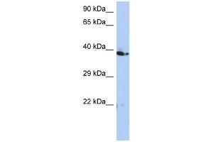 C10ORF46 antibody used at 1 ug/ml to detect target protein. (CACUL1 anticorps  (Middle Region))