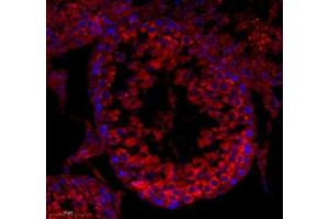 Immunofluorescence of paraffin embedded rat testis using cfap58 (ABIN7073535) at dilution of 1: 650 (300x lens) (CCDC147 anticorps)