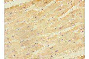 Immunohistochemistry of paraffin-embedded human heart tissue using ABIN7151514 at dilution of 1:100 (EAF2 anticorps  (AA 1-170))