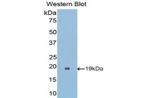 Western Blotting (WB) image for anti-Superoxide Dismutase 1, Soluble (SOD1) (AA 2-154) antibody (ABIN1078539) (SOD1 anticorps  (AA 2-154))