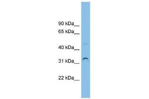 SECTM1 antibody used at 1 ug/ml to detect target protein. (SECTM1 anticorps  (Middle Region))