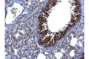 IHC-P Image MTMR9 antibody [C3], C-term detects MTMR9 protein at cytoplasm on mouse lung by immunohistochemical analysis. (MTMR9 anticorps  (C-Term))
