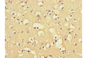Immunohistochemistry of paraffin-embedded human brain tissue using ABIN7160057 at dilution of 1:100