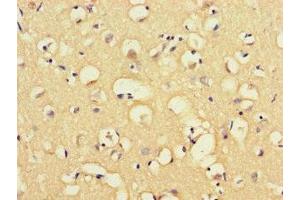 Immunohistochemistry of paraffin-embedded human brain tissue using ABIN7160057 at dilution of 1:100 (MAP3K8 anticorps  (AA 1-300))