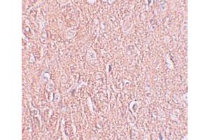 Immunohistochemical staining of human brain cells with LRRTM2 polyclonal antibody  at 2. (LRRTM2 anticorps  (C-Term))