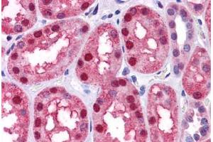 Human Kidney: Formalin-Fixed, Paraffin-Embedded (FFPE) (BMP7 anticorps  (AA 165-214))