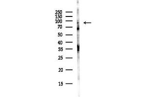 Western blot analysis of lysates from Hela cells(UV, 30 min treatment), using XRR Antibody at 1/1000 dilution.