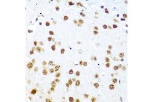 Immunohistochemistry of paraffin-embedded mouse brain using CASP9 antibody at dilution of 1:100 (40x lens). (Caspase 9 anticorps)