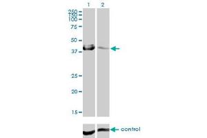 Western blot analysis of CA12 over-expressed 293 cell line, cotransfected with CA12 Validated Chimera RNAi (Lane 2) or non-transfected control (Lane 1). (CA12 anticorps  (AA 25-124))