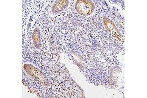IHC analysis of CXCR2 using anti-CXCR2 antibody (ABIN7601315).