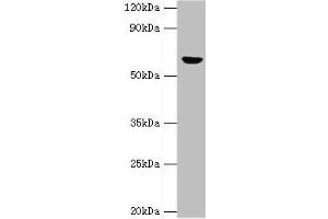 Western blot All lanes: GLUD2 antibody at 2 μg/mL + 293T whole cell lysate Secondary Goat polyclonal to rabbit IgG at 1/10000 dilution Predicted band size: 61 kDa Observed band size: 61 kDa (GLUD2 anticorps  (AA 319-558))