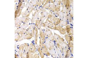 Immunohistochemistry of paraffin-embedded rat heart using MBNL1 antibody (ABIN5975763) at dilution of 1/100 (40x lens). (MBNL1 anticorps)