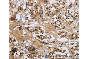 Immunohistochemistry of Human tonsil using LGALS7 Polyclonal Antibody at dilution of 1:50 (LGALS7 anticorps)
