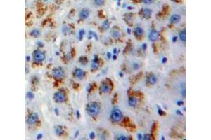 Used in DAB staining on fromalin fixed paraffin-embedded Liver tissue (GOLM1 anticorps  (AA 119-223))