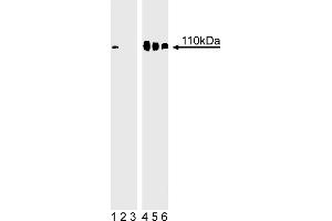 Western Blotting (WB) image for anti-Retinoblastoma 1 (RB1) (pSer780) antibody (ABIN967604)