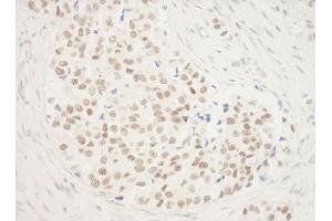 anti-Zinc Finger Protein 768 (ZNF768) (AA 1-15) antibody