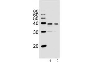 Western blot analysis of lysate from 1) PC3, and 2) LNCaP cell line using VDR antibody at 1:1000.