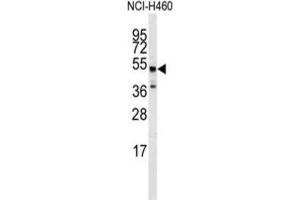 Western Blotting (WB) image for anti-Adrenergic, beta-2-, Receptor, Surface (ADRB2) antibody (ABIN3003093) (beta 2 Adrenergic Receptor anticorps)