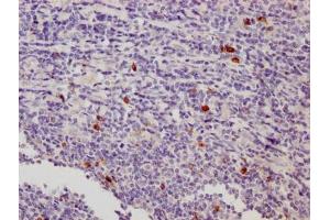 IHC image of ABIN7158617 diluted at 1:500 and staining in paraffin-embedded human tonsil tissue performed on a Leica BondTM system.