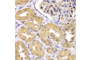 Immunohistochemistry of paraffin-embedded human kidney using LZTR1 antibody at dilution of 1:100 (x400 lens). (LZTR1 anticorps)