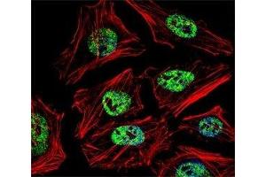 Fluorescent confocal image of HeLa cell stained with NANOG antibody at 1:25.