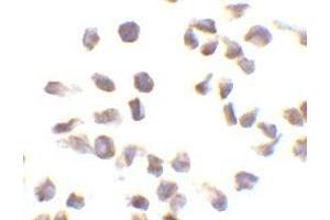 Immunocytochemistry of Ipaf in THP-1 cells with AP30437PU-N Ipaf antibody at 10 μg/ml.