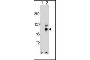 Western blot analysis of GNL2 (arrow) using GNL2 / NGP1 Antibody (N-term) Cat. (GNL2 anticorps  (N-Term))