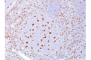 Formalin-fixed, paraffin-embedded human Tonsil stained with CD68 Mouse Monoclonal Antibody (C68/684).