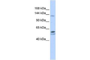PUM2 antibody used at 1 ug/ml to detect target protein. (PUM2 anticorps)