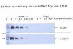Image no. 1 for anti-Glycoprotein E2 antibody (ABIN1742586) (Glycoprotein E2 anticorps)