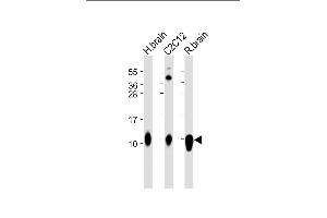 All lanes : Anti-S100B Antibody at 1:2000 dilution Lane 1: Human brain lysate Lane 2: C2C12 whole cell lysate Lane 3: Rat brain lysate Lysates/proteins at 20 μg per lane.