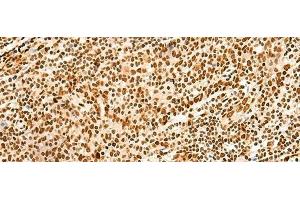Immunohistochemistry of paraffin-embedded Human tonsil tissue using HNRNPA3 Polyclonal Antibody at dilution of 1:45(x200)