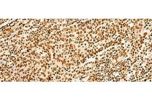 Immunohistochemistry of paraffin-embedded Human tonsil tissue using HNRNPA3 Polyclonal Antibody at dilution of 1:45(x200) (HNRNPA3 anticorps)