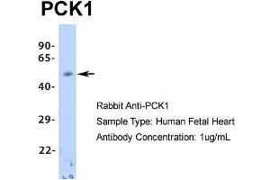 Host: Rabbit  Target Name: PCK1  Sample Tissue: Human Fetal Heart  Antibody Dilution: 1.