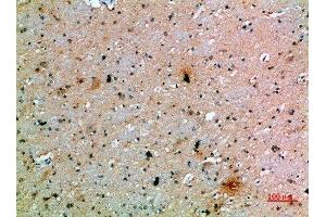 Immunohistochemical analysis of paraffin-embedded human-brain, antibody was diluted at 1:200 (PDGFC anticorps  (AA 61-110))