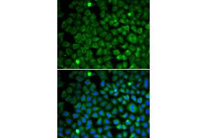 Immunofluorescence analysis of U2OS cells using NUP62 antibody. (NUP62 anticorps)