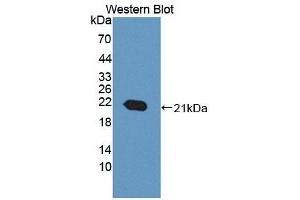 Detection of Recombinant ACD, Mouse using Polyclonal Antibody to Adrenocortical Dysplasia Homolog (ACD) (ACD anticorps  (AA 21-175))