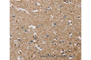 Immunohistochemistry of Human brain  using PIP4K2A Polyclonal Antibody at dilution of 1:40 (PIP4K2A anticorps)